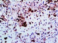 Herpes Simplex Virus II (Polyclonal), RPab MAIN