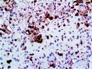 Herpes Simplex Virus II (Polyclonal), RPab THUMBNAIL