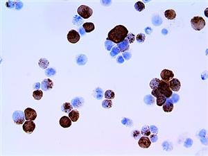 Herpes Simplex Virus II (BSB-116), MMab MAIN