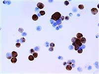 Herpes Simplex Virus II (BSB-116), MMab MAIN