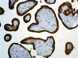 hCG (BSB-38), MMab MAIN