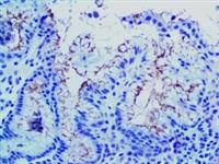 Helicobacter Pylori (BSB-37), MMab MAIN