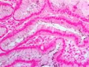 Helicobacter pylori (Polyclonal), RPab THUMBNAIL