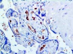 Hemoglobin A (EP124), RMab MAIN