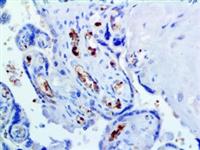 Hemoglobin A (EP124), RMab MAIN
