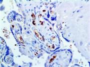 Hemoglobin A (EP124), RMab THUMBNAIL