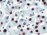 Hepatitis B Virus Core Antigen (Polyclonal), RPab MAIN