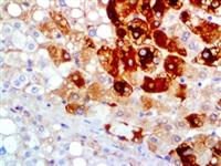 Hepatitis B Virus Surface Antigen (A10F1), MMab MAIN