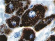 Hepatocyte Specific Antigen / Hep-Par1 (OCH1E5), MMab THUMBNAIL
