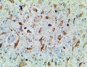 IDH1 R132H (IHC132), MMab MAIN