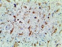 IDH1 R132H (IHC132), MMab MAIN