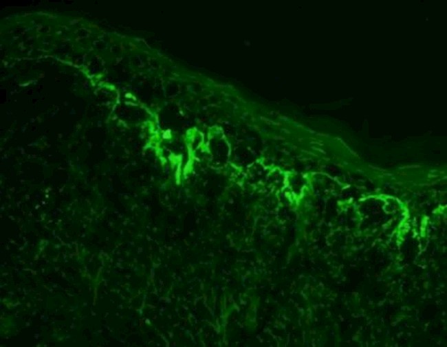 Mouse/Rabbit AmpliDetector Plus FITC with FluoroMounter with DAPI – Bio ...