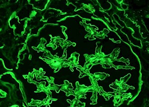 Mouse/Rabbit AmpliDetector Plus FITC MAIN