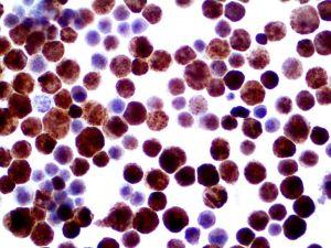 Herpes Simplex Virus I & II (Polyclonal), RPab MAIN
