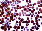 Herpes Simplex Virus I & II (Polyclonal), RPab THUMBNAIL