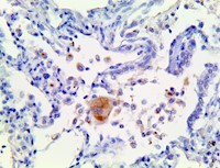 il-6, il6, anti-il6, anti-il-6, il6 antibody, anti-il-6 antibody, cytokine storm, cytokine storm syndrome, cytokine stor MAIN