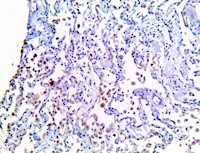 il-1a, il1a, anti-il1a, anti-il-1a, il1a antibody, anti-il-1a antibody, cytokine storm, cytokine storm syndrome, cytokin MAIN