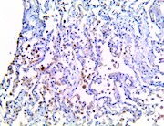 il-1a, il1a, anti-il1a, anti-il-1a, il1a antibody, anti-il-1a antibody, cytokine storm, cytokine storm syndrome, cytokin THUMBNAIL