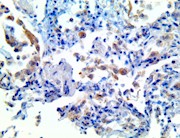 il-1b, il1b, anti-il1b, anti-il-1b, il1b antibody, anti-il-1b antibody, cytokine storm, cytokine storm syndrome, cytokin THUMBNAIL