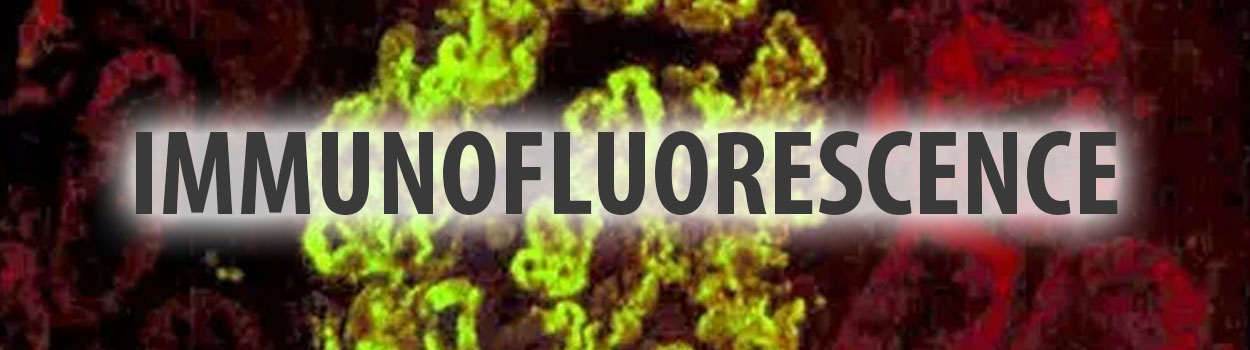 Immunofluorescence, IF, FITC, autoimmunity, InDirect IF, Direct IF