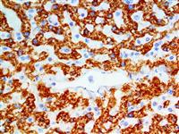 IMP-3 / 1GF2BP3 (EP286), RMab MAIN