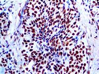 INI-1 (25), MMab MAIN