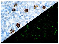 IgA (BSB-39), MMab MAIN