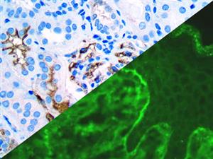 IgA (Polyclonal), RPab MAIN
