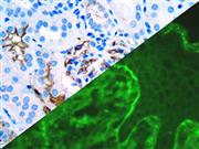 IgA (Polyclonal), RPab THUMBNAIL