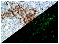 IgD (EP173), RMab MAIN