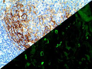 IgE (Polyclonal), RPab MAIN