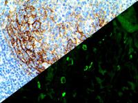 IgE (Polyclonal), RPab MAIN