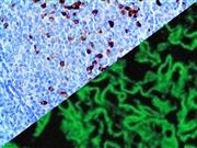 IgG (Polyclonal), RPab THUMBNAIL