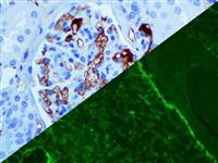 IgM (Polyclonal), RPab MAIN