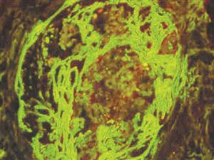 Fibrinogen/FITC (Polyclonal), RPab MAIN
