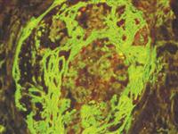 Fibrinogen/FITC (Polyclonal), RPab MAIN