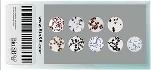 Varicella Zoster Virus Cell Line Array (2 Core) MAIN