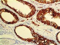 Inhibin alpha (R1), MMab MAIN