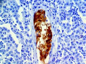 Inhibin alpha (EP378), RMab MAIN
