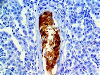Inhibin alpha (EP378), RMab MAIN