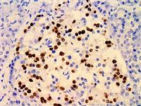 Islet 1 / ISL1 (EP283), RMab MAIN