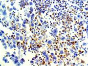 LAG-3 / CD223 (EP294), RMab THUMBNAIL
