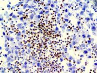 LEF-1 (EP310), RMab MAIN