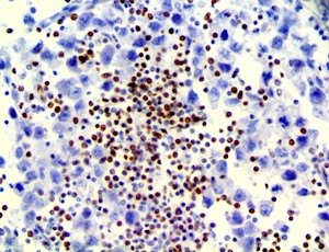 LEF1 (RBT-LEF1), RMab MAIN