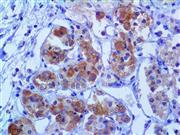 LH / Luteinizing Hormone (BSB-53), MMab THUMBNAIL