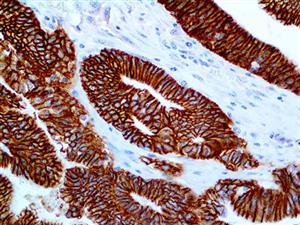 Cadherin-17 / LI-Cadherin (EP86), RMab MAIN