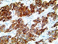 LIN28 (EP150), RMab MAIN