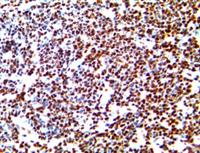 LMO2 (RBT-LM02), RMab MAIN