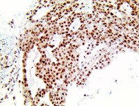 mgmt, agat, anti-mgmt, anti-agat, agt, anti-agt MAIN