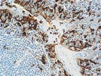 Lysozyme (EP134), RMab MAIN